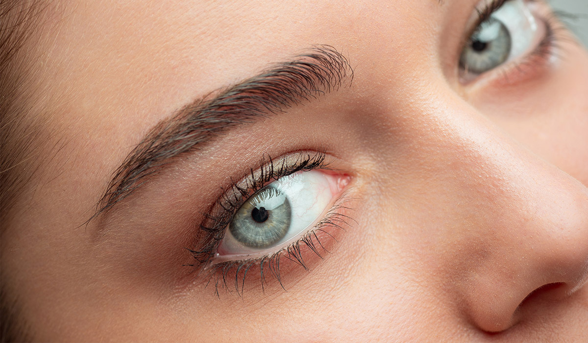 Blefaroplastia2